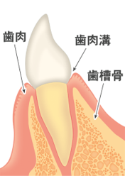 歯を失う一番の病気です、歯肉、歯肉溝、歯槽骨